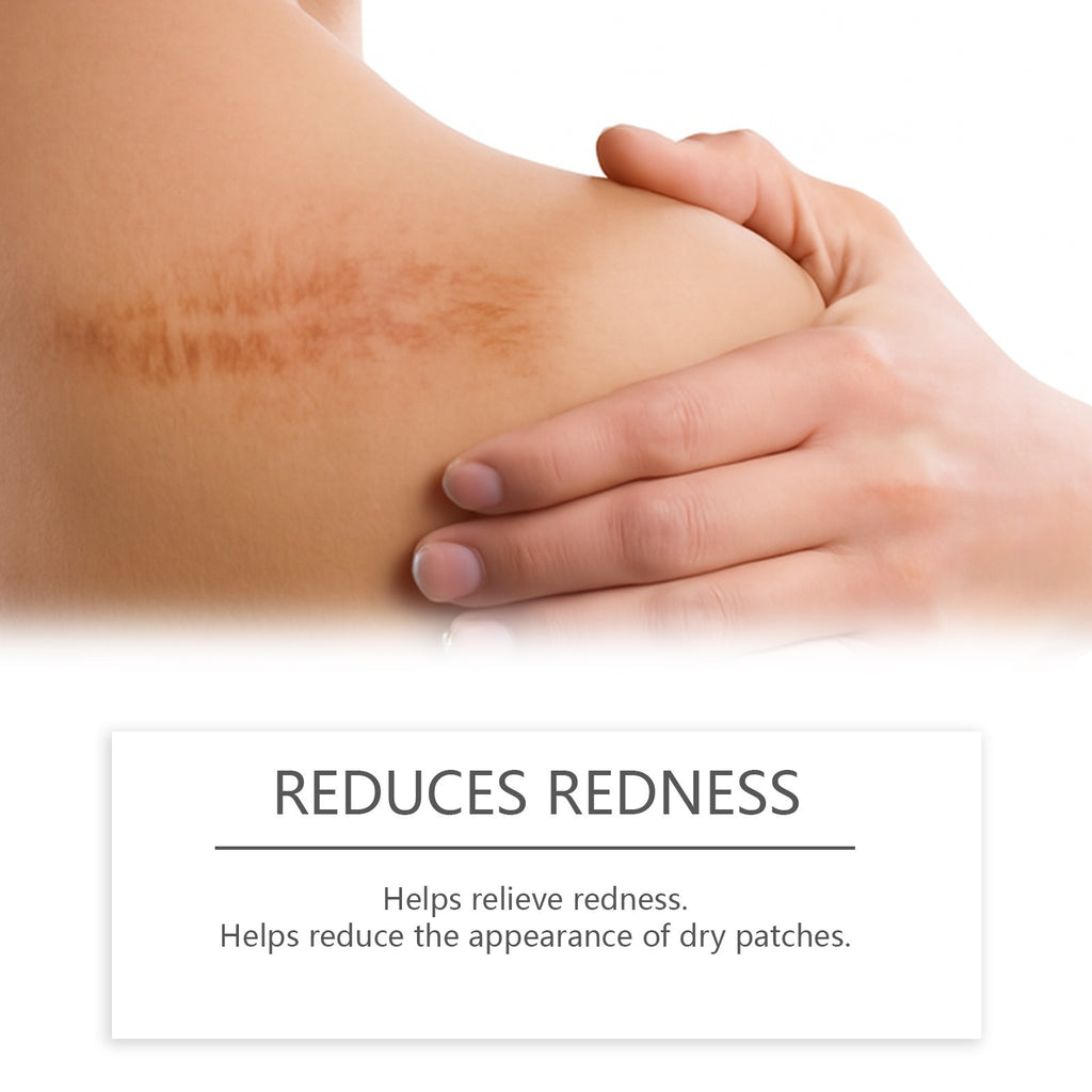 Skin Scar Moisturizing Care Stick