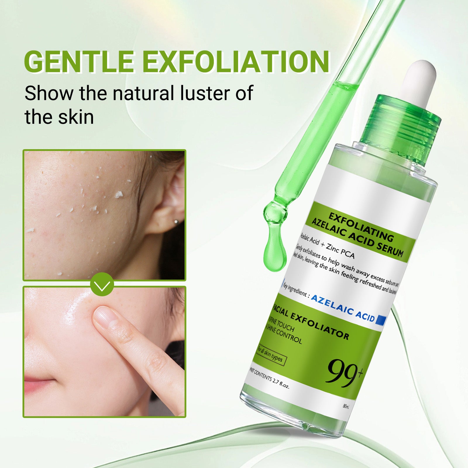 Azelaic Acid Exfoliating Essence Moisturizing Skin Care 80ml