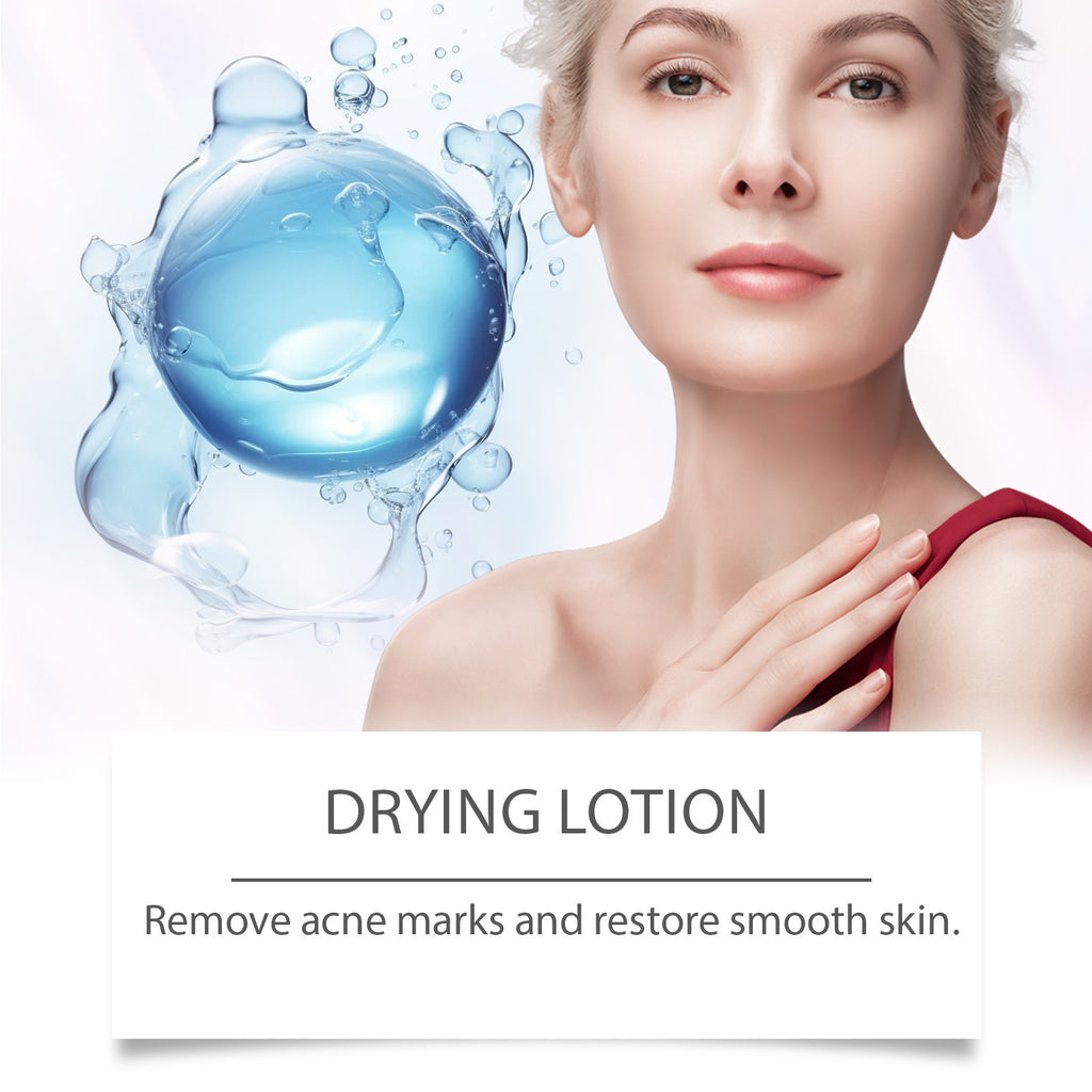 Acne Skin Care Moisturizing Essence